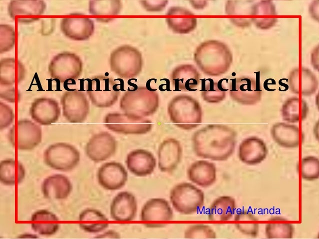 anemias carenciales